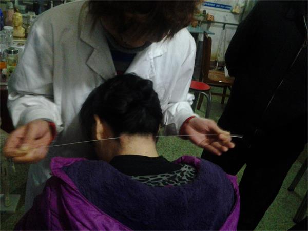 濟(jì)寧哪里可以學(xué)針灸技術(shù)？